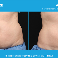 Laser MD MedSpa