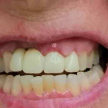 Atlantic Florida Dental - General Dentistry Near Me - Dania Beach, Florida Atlantic Florida Dental - General Dentistry Near Me - Dania Beach, Florida