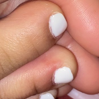Legacy Nails Lounge - did not file to any shape/length & topped it off with my nails not even coated evenly & an infection coming in where my toe is red - Nail Salons Near Me - Lynwood, California Legacy Nails Lounge - did not file to any shape/length & topped it off with my nails not even coated evenly & an infection coming in where my toe is red - Nail Salons Near Me - Lynwood, California