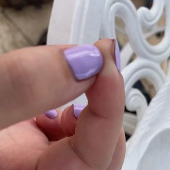 World Star Nails - More peeling on pointer - Nail Salons Near Me - Tinley Park, Illinois