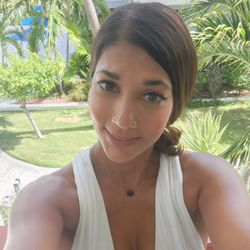 Natural Looks - After microneedling