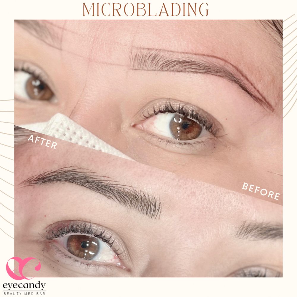 EYE CANDY REJUVENATION CENTER 305 Photos 5801 Lincoln Ave, Buena