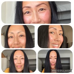 Before and after