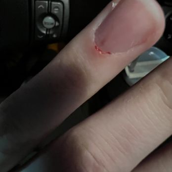 Queen Bee Nail & Spa - Right after finger was cut - Nail Salons Near Me - Hamilton, New Jersey