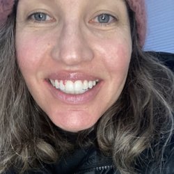 Jerad L. West, DDS - West Orthodontics - Braces off!!