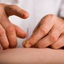Photo of EZCD Detox Acupuncture