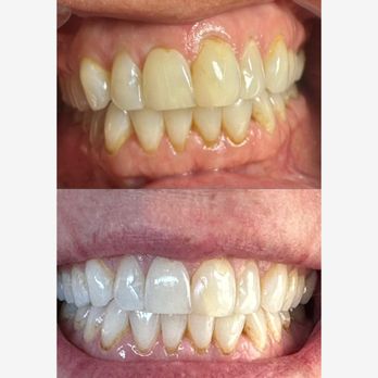 Tans and Teeth - Spray Tanning Near Me - Scottsdale, Arizona Tans and Teeth - Spray Tanning Near Me - Scottsdale, Arizona