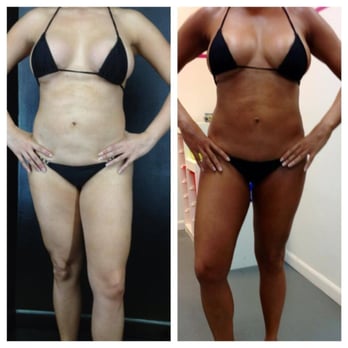 Aventura Spray Tan - Spray Tanning Near Me - Miami, Florida