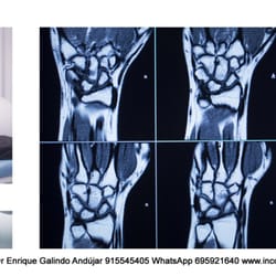Instituto Madrileño de Traumatología - Resonancia abierta de alto campo para extremidades.