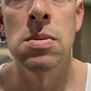 Southern Smiles Dental Studio - "What happened to your face?" - General Dentistry Near Me - Columbia, South Carolina Southern Smiles Dental Studio - "What happened to your face?" - General Dentistry Near Me - Columbia, South Carolina