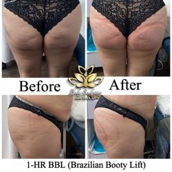 Body Sculpting Chula Vista & Spa