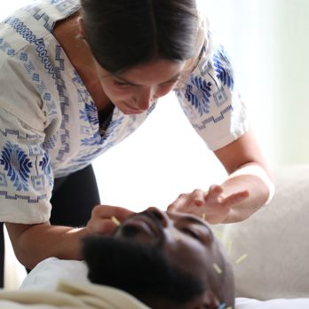 Gaslamp Chiropractic - Our liscenced acupuncturist performing acupuncture placing needles on patients head - Chiropractors Near Me - San Diego, California Gaslamp Chiropractic - Our liscenced acupuncturist performing acupuncture placing needles on patients head - Chiropractors Near Me - San Diego, California