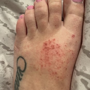 New York Everlasting Nails - A few days after pedicure - Nail Salons Near Me - Babylon, New York