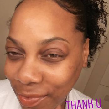 Body Oasis Day Spa - Essential vitamin facial for acne - Massage Near Me - Torrance, California Body Oasis Day Spa - Essential vitamin facial for acne - Massage Near Me - Torrance, California