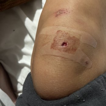 Circa - From being thrown to the ground with excessive force - Casinos Near Me - Las Vegas, Nevada