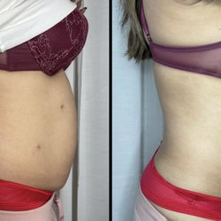 Divine Curves - 1 treatment