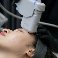 Valentina's Studio - Ultherapy!