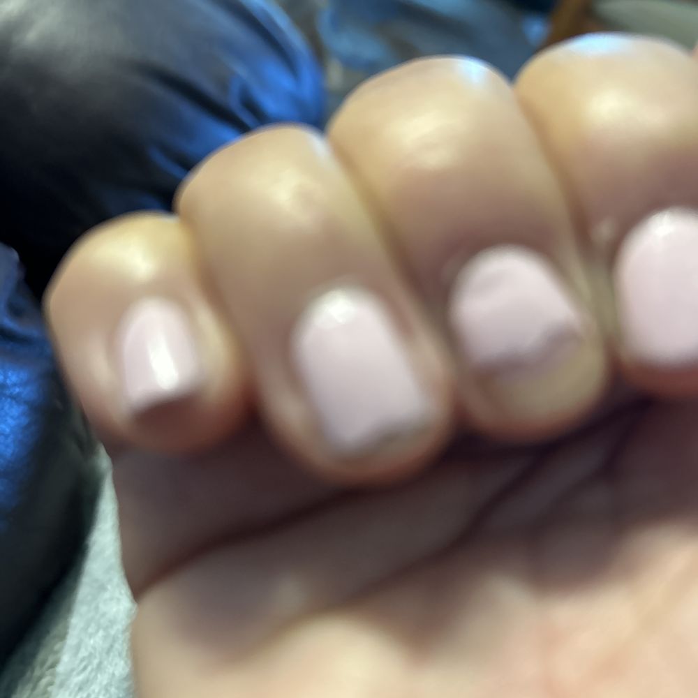 Chipped nails