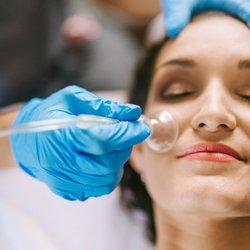 Nina Hamid Acupuncture - Facial Cupping