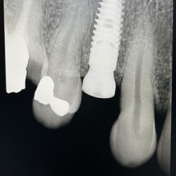Elite Dental Care