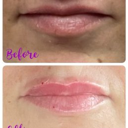 before and after before and after