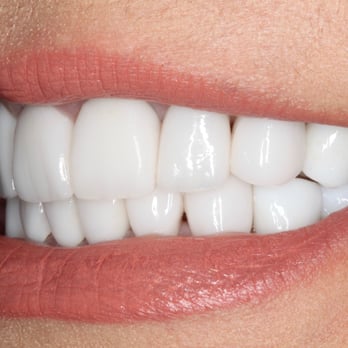 Michael W Brumm, DMD - Cosmetic Dentists Near Me - Clearwater, Florida Michael W Brumm, DMD - Cosmetic Dentists Near Me - Clearwater, Florida