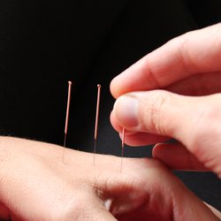 Flux Acupuncture Lounge - Watsonville