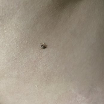 Skycloud Reflexology - Bedbugs - Reflexology Near Me - Tempe, Arizona