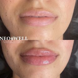 NeoWell