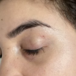 Eyebrow R Us - The cut under my eyebrow, it has been bothering me.