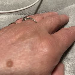 Walmart Supercenter - Swollen hand