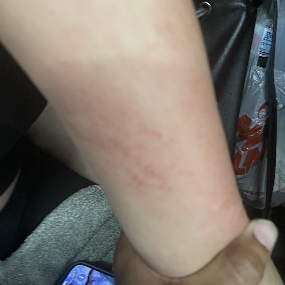 Wanda Coach - This is while we was in the bus . 18 hour ride feeling itchy - Public Transportation Near Me Wanda Coach - This is while we was in the bus . 18 hour ride feeling itchy - Public Transportation Near Me