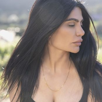 Ashkan Ghavami, MD - 2 year rhinoplasty - Plastic Surgeons Near Me - Beverly Hills, California