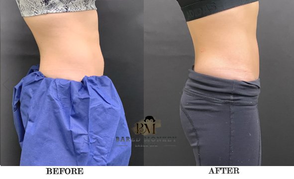 Bared Monkey Laser Spa by null