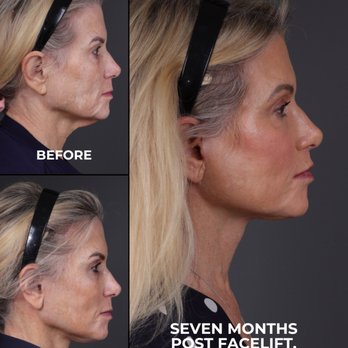 Cheng Plastic Surgery - Cosmetic Surgeons Near Me - Saratoga, California Cheng Plastic Surgery - Cosmetic Surgeons Near Me - Saratoga, California