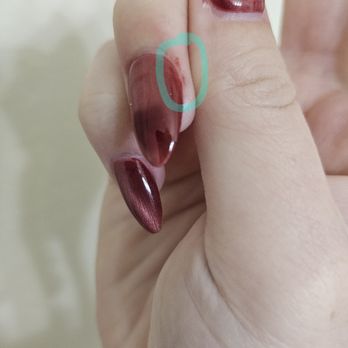 Me Time Beauty Lounge - Right hand ring finger (other side) this too is on the cuticle line that starts to curve on to the nails. Pain 10/10 - Eyelash Service Near Me - Brea, California Me Time Beauty Lounge - Right hand ring finger (other side) this too is on the cuticle line that starts to curve on to the nails. Pain 10/10 - Eyelash Service Near Me - Brea, California