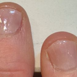 Dried out dead skin all over Sloppy painted edges