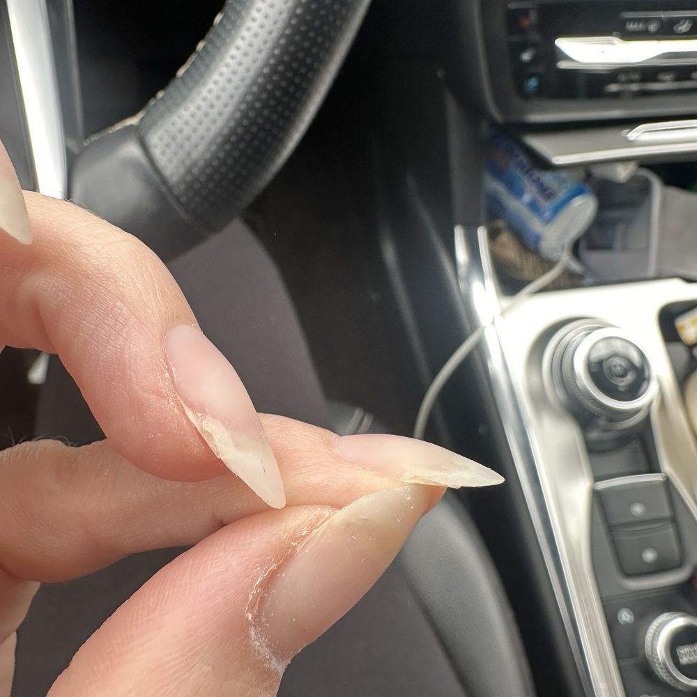 Peter's Nails - Another example of poor acrylic application with refusal to fix. This is how they were going to paint them - Nail Salons Near Me - Lafayette, Louisiana Peter's Nails - Another example of poor acrylic application with refusal to fix. This is how they were going to paint them - Nail Salons Near Me - Lafayette, Louisiana