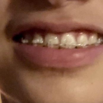 Katherine M Masaki, DDS, MS - Braces still on - Orthodontists Near Me - Honolulu, Hawaii