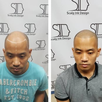 Hair Tattoo Can Help You Bring Back The Image You Ve Lost Due To