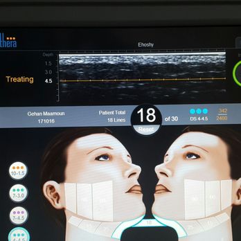 Khaled El-Hoshy, MD PC - Ulthera: skin tightening without surgery - Dermatologists Near Me - Livonia, Michigan Khaled El-Hoshy, MD PC - Ulthera: skin tightening without surgery - Dermatologists Near Me - Livonia, Michigan
