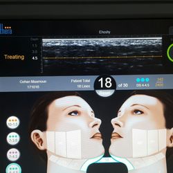 Khaled El-Hoshy, MD PC - Ulthera: skin tightening without surgery