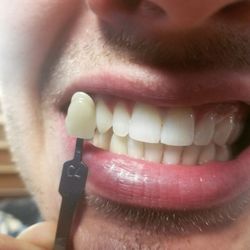 Radiant White Smiles of Austin - Radiant White Smiles of Austin
Stains ALL Gone!!
Book Today!
www.radiantwhitesmiles.com
512 566 7209