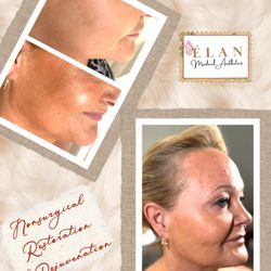 ELAN Medical Aesthetics