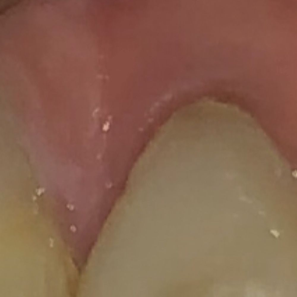 Robert Elloway, DDS - His idea of $2200 Terrible at a simple filling Go somewhere else - Cosmetic Dentists Near Me - Riverside, California Robert Elloway, DDS - His idea of $2200 Terrible at a simple filling Go somewhere else - Cosmetic Dentists Near Me - Riverside, California