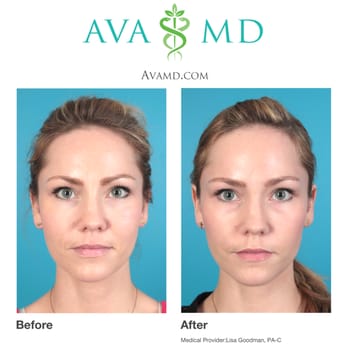 Ava MD - Dermatologists Near Me - Beverly Hills, California Ava MD - Dermatologists Near Me - Beverly Hills, California