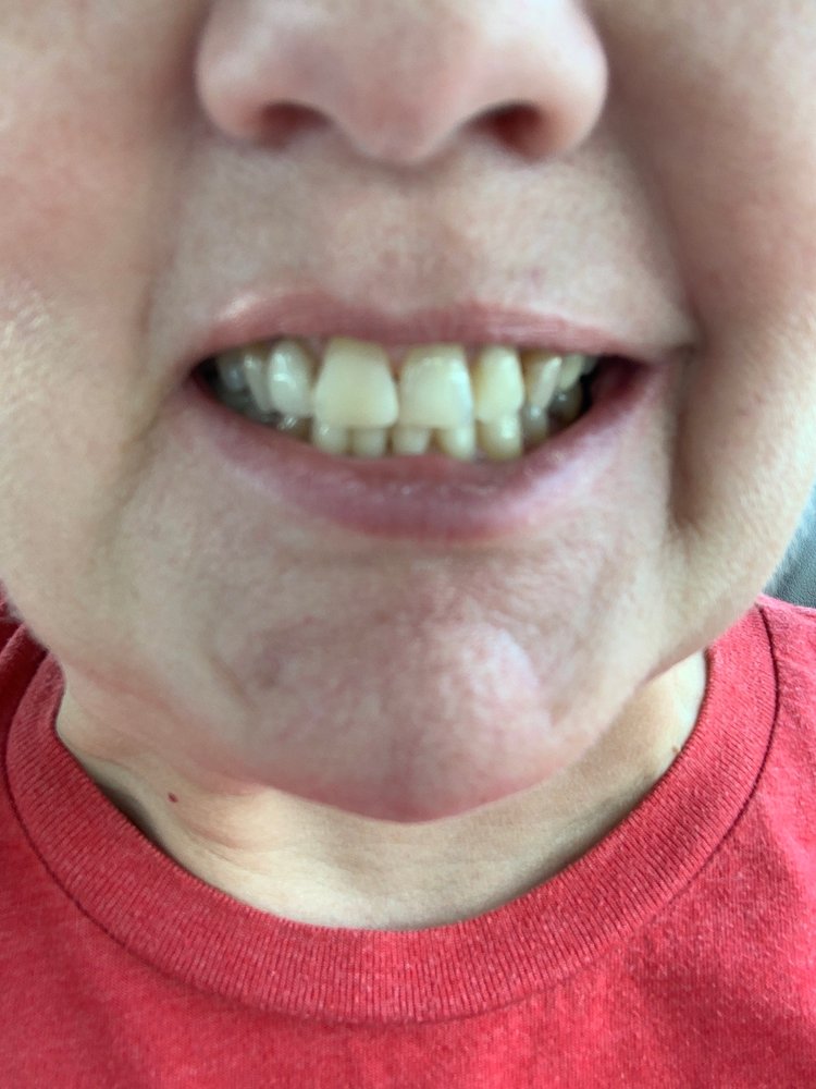 MARKET COMMON DENTISTRY 10 Photos & 26 Reviews Cosmetic Dentists