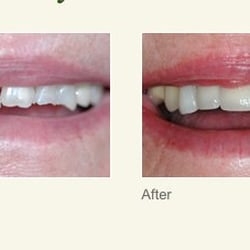 A J Gollofon, DDS