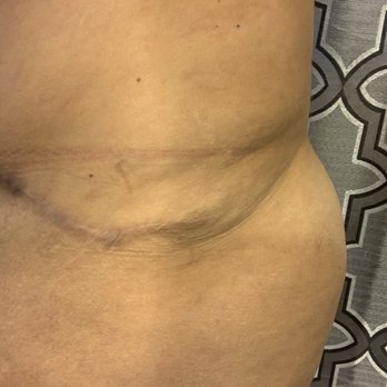 Daniel G Kolder, MD - Pacifica Center for Plastic Surgery - Cosmetic Surgeons Near Me - Camarillo, California