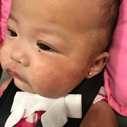 My 4month old got here ear pierced.